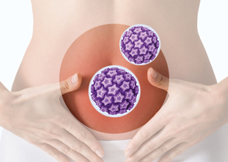 Neuraltherapie bei HPV